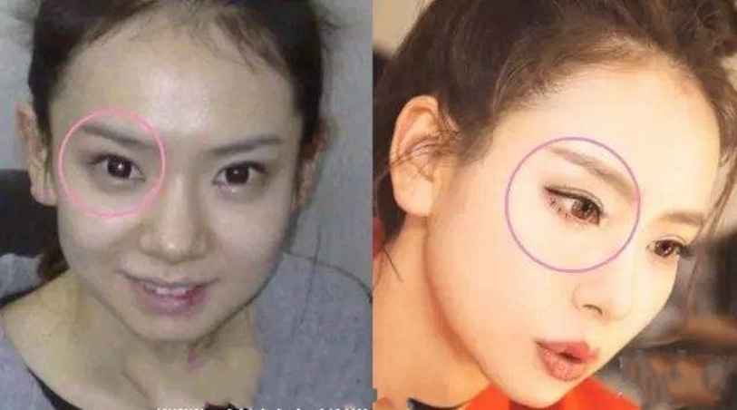 原来她也是整过容的，有人整得美若天仙，有人却没那么好运了