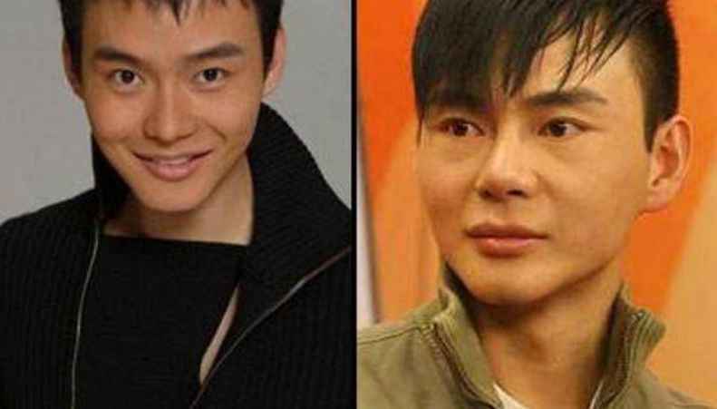 原来她也是整过容的，有人整得美若天仙，有人却没那么好运了