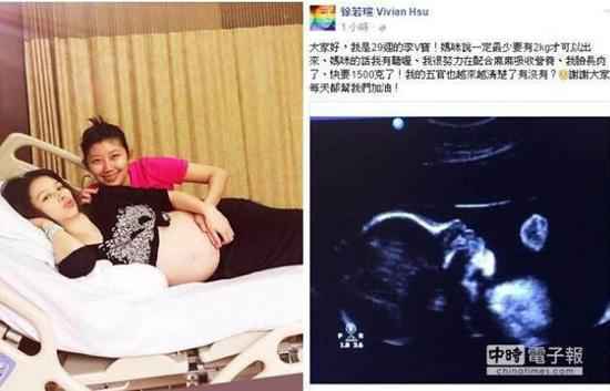 徐若瑄晒29周超声波照 得意肚中胎儿长肉