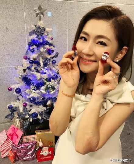 满满的恶意!Selina露伤疤被骂博同情