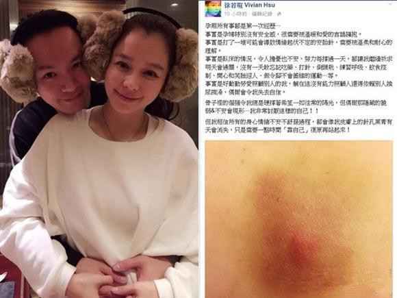 40岁徐若瑄怀孕27周需别人倒尿擦澡 称讨厌自己