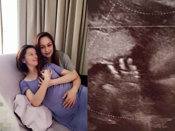 40岁徐若瑄怀孕27周需别人倒尿擦澡 称讨厌自己