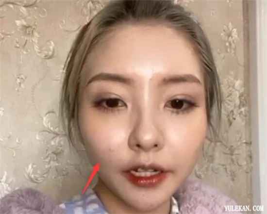 王思聪前女友豆得儿关了美颜脸上全是痘为何又开直播？