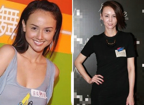 港星整容失败！面部塌陷！