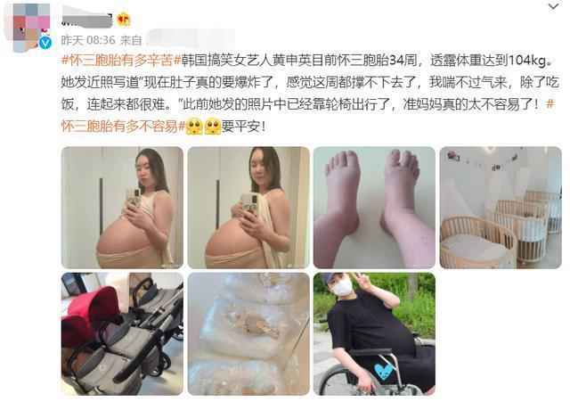 韩女星怀三胞胎自嘲肚子要炸 双脚浮肿坐轮椅出行