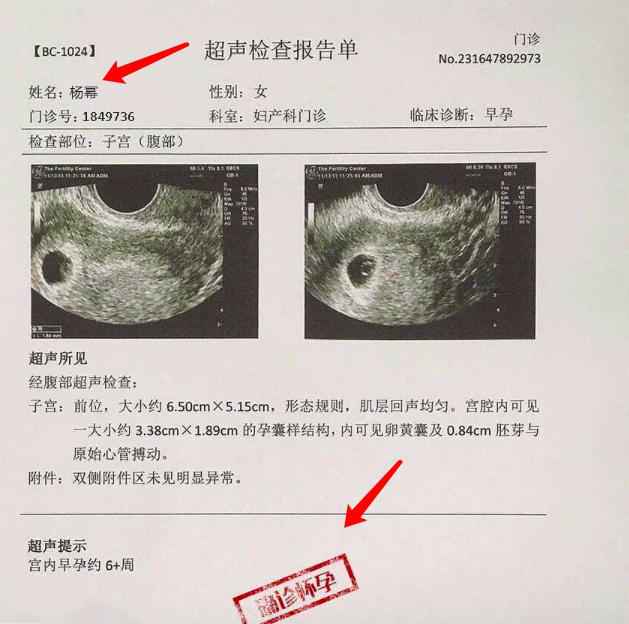 杨幂凌晨公布二胎喜讯是怎么回事,魏大勋杨幂再次怀孕是真的吗